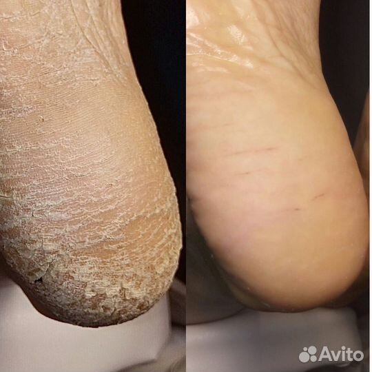 Маникюр + смартпедикюр