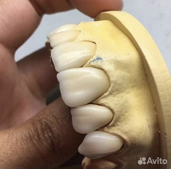 Зубной техник керамист