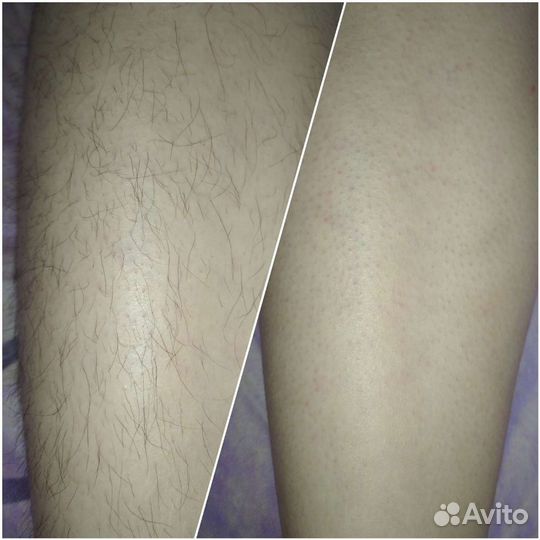 SPA Шугаринг