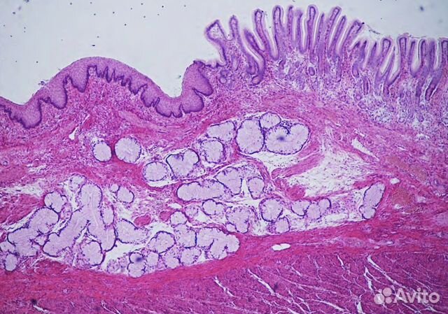 Репетитор по гистологии. Стенка пищевода не имеет слоя оболочки. Репетитор по гистологии. Лейомиосаркома препарат. Пилорический отдел желудка гистология.