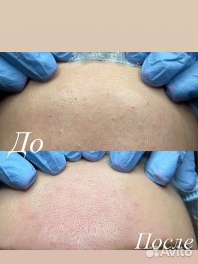 Услуги косметолога