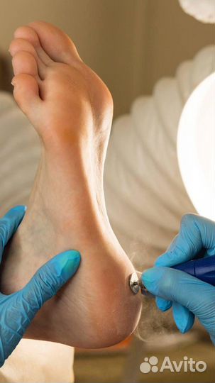 Педикюр SMART