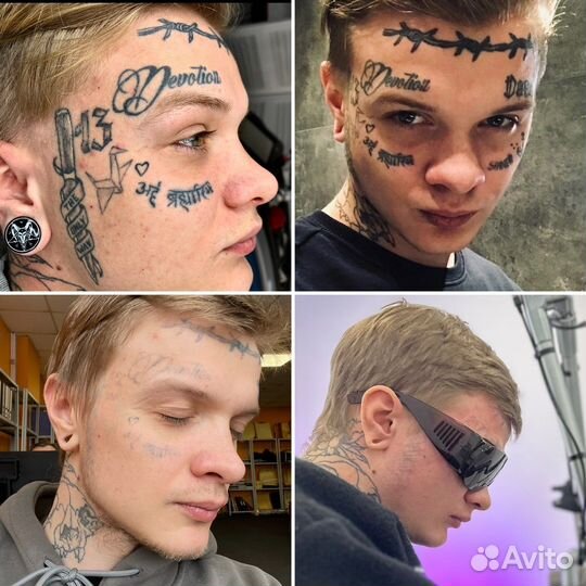 Удаление тату и татуажа в клинике Sokolov Laser