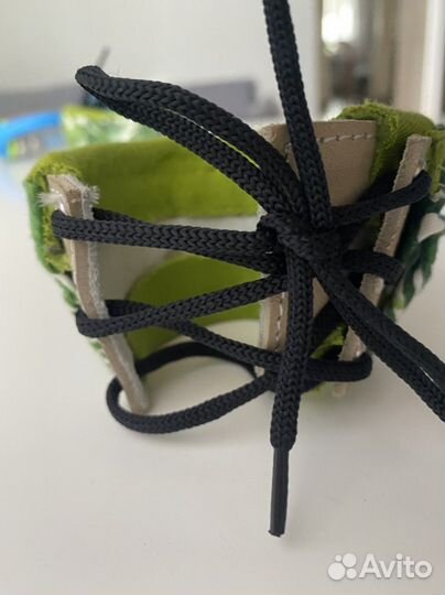 Распорка/Шина Виленского размер 1