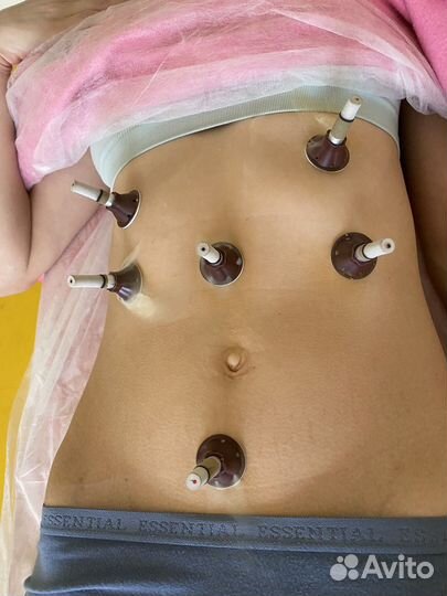 Моксатерапия