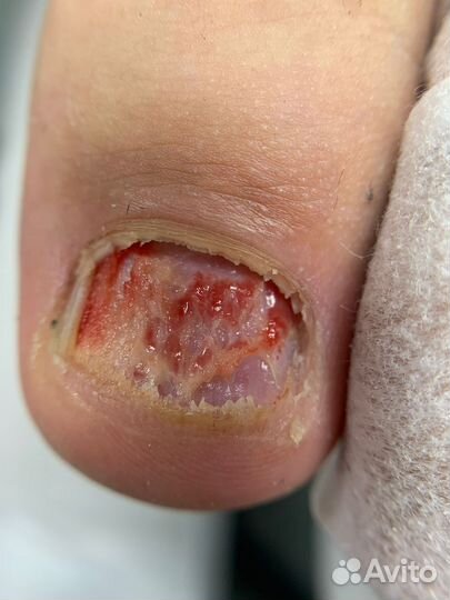 Модель на медицинский педикюр