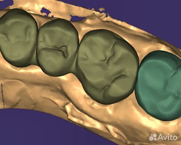 Cad cam Фрезеровка по stl