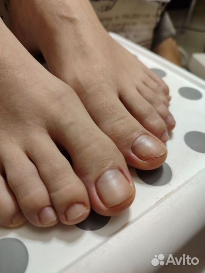 Медицинский педикюр с выездом на дом