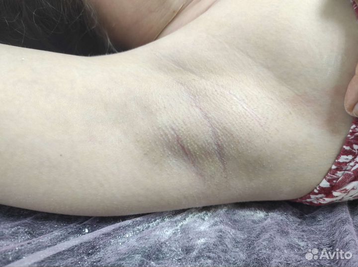 Депиляция воском: глубокое бикини