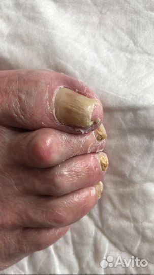 Педикюр старикам выезд на дом