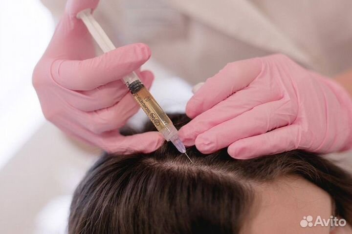 Плазмолифтинг