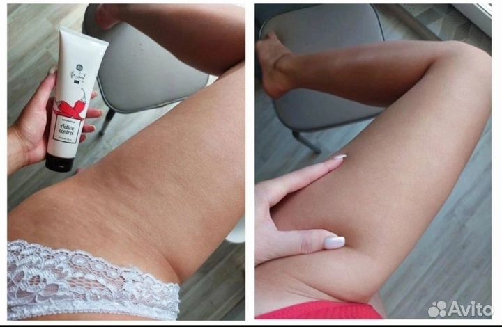 Антицеллюлитный гель 