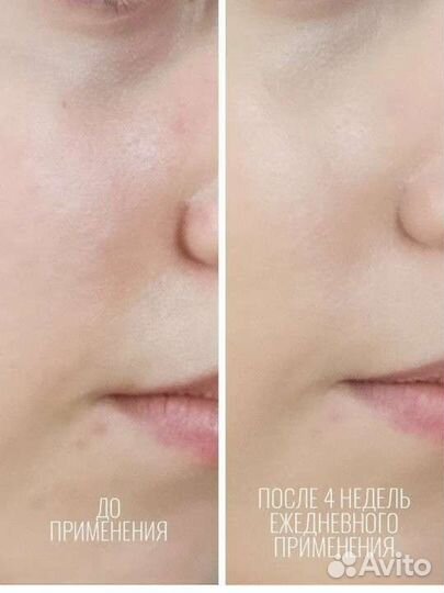 Сыворотка 60 ампул с витамином С