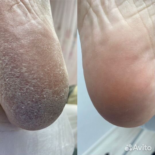 Мастер маникюра и педикюра