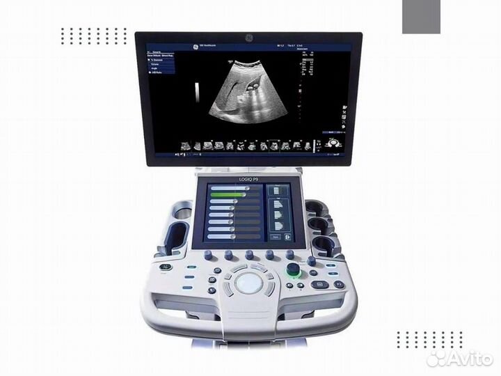 Узи GE Voluson S8