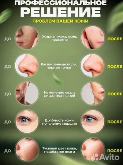 Массажер для лица