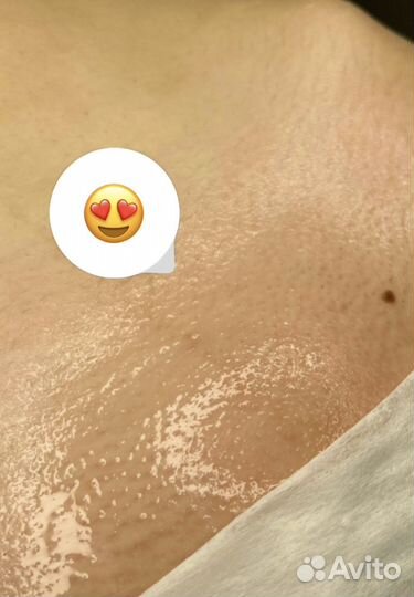 Депиляция Шугаринг