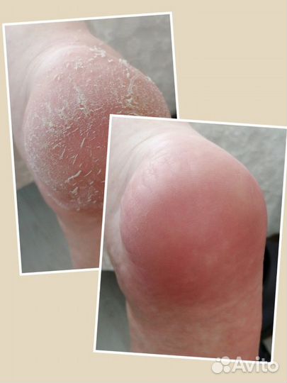 Маникюр, педикюр, наращивание ногтей