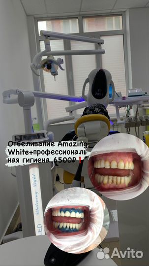 Отбеливание