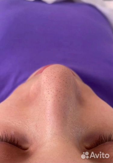 Косметология чистка лица