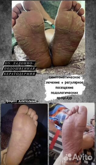 Онлайн Консультация врача-Дерматолога Косметолога