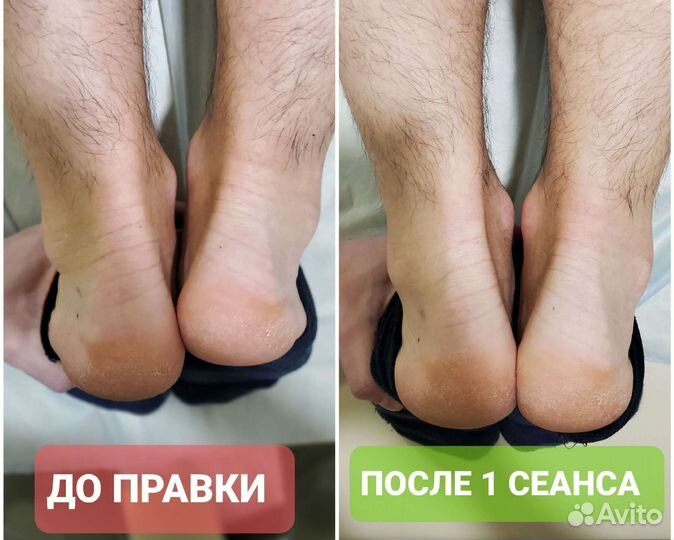 Костоправ в Йошкар-Оле