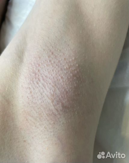 Модель на депиляцию