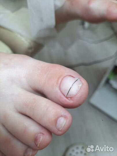 Курсы по подологии для начинающих