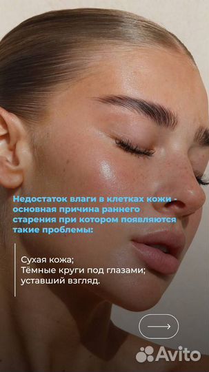 Биоревитализация. Мезотерапия