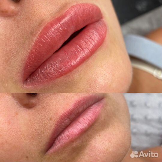 Перманентный макияж. Лазерное удаление пм/ тату