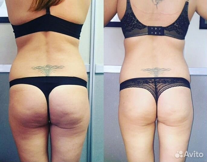 Коррекция фигуры. Изоджей. Гимнастика для ленивых