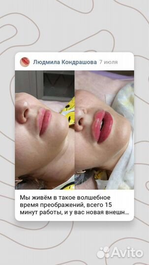 Услуги косметолога