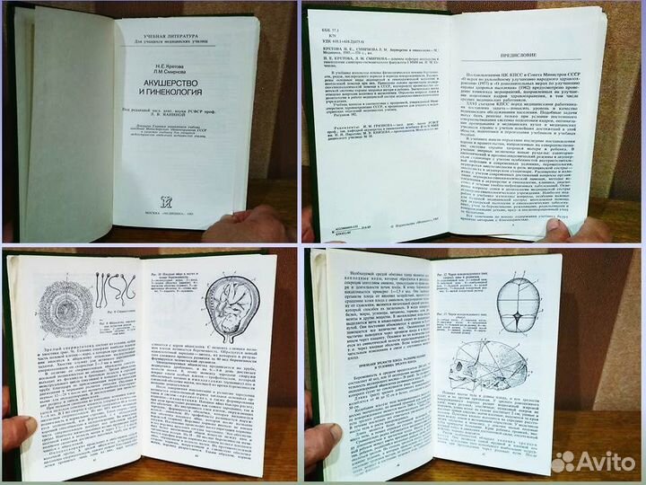 Акушерство и гинекология Кретова Смирнов
