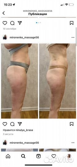 Антицеллюлитный массаж