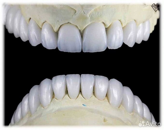 Изготовление зубных протезов