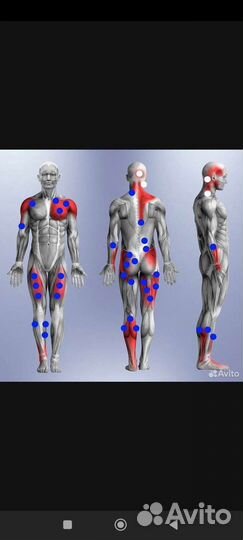 Массаж тригерных точек