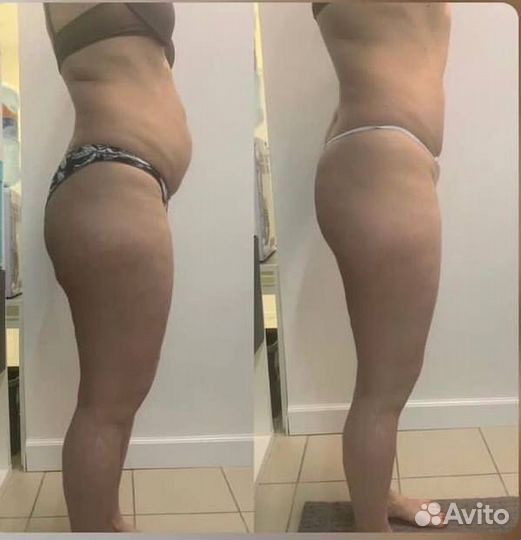 Гидромассаж похудение