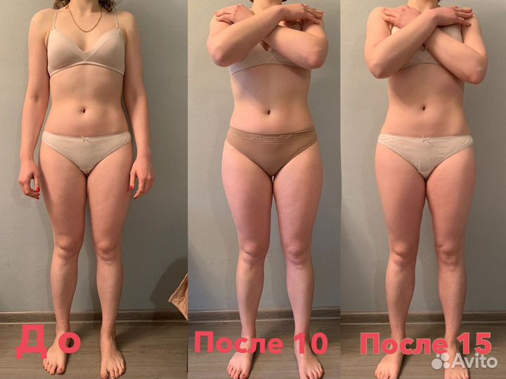 Массаж, массаж лица, RF, кавитация, лазерный липол