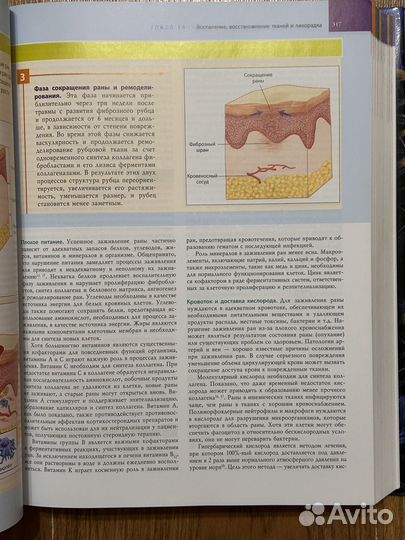 Патофизиология Порт