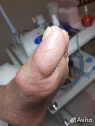 Мужской, женский педикюр