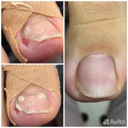 Педикюр гмр, подолог гмр