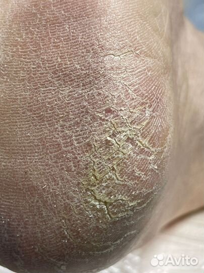 Ищем модель с проблемными ногами