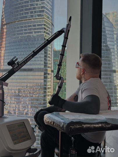 Лазерное удаление татуировок / удаление тату