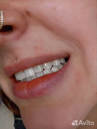 Скайсы, стразы на зубы