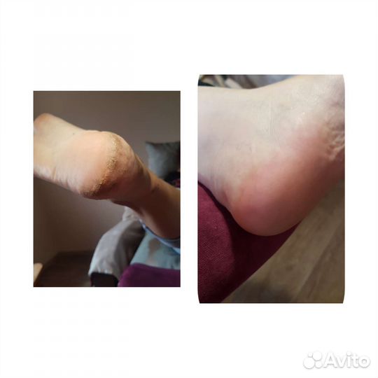 Педикюр Маникюр