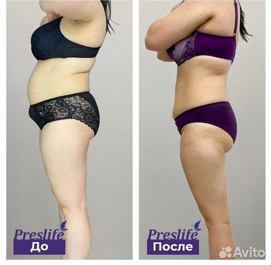 Аппаратная коррекция фигуры. Плоский живот