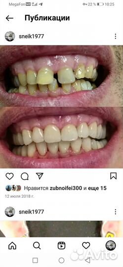 Зубной техник керамист