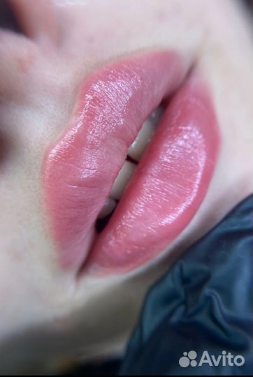 Увеличение губ