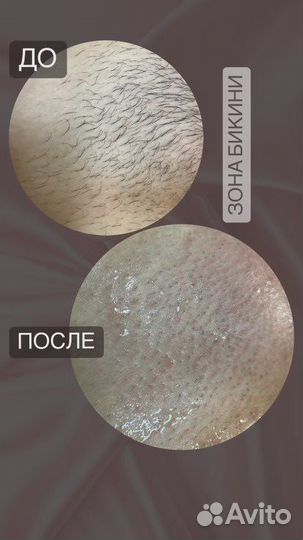 Гелинг