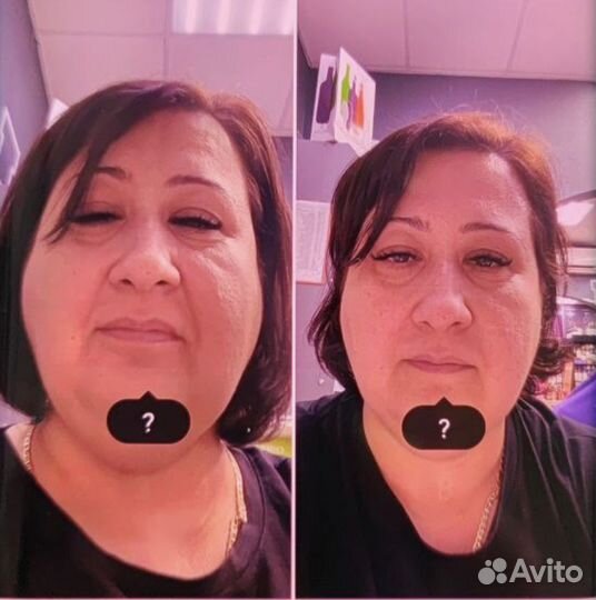 Худое тело, лицо